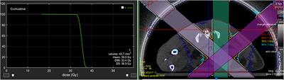 Pre-clinical Research on Bladder Toxicity After Radiotherapy for Pelvic Cancers: State-of-the Art and Challenges